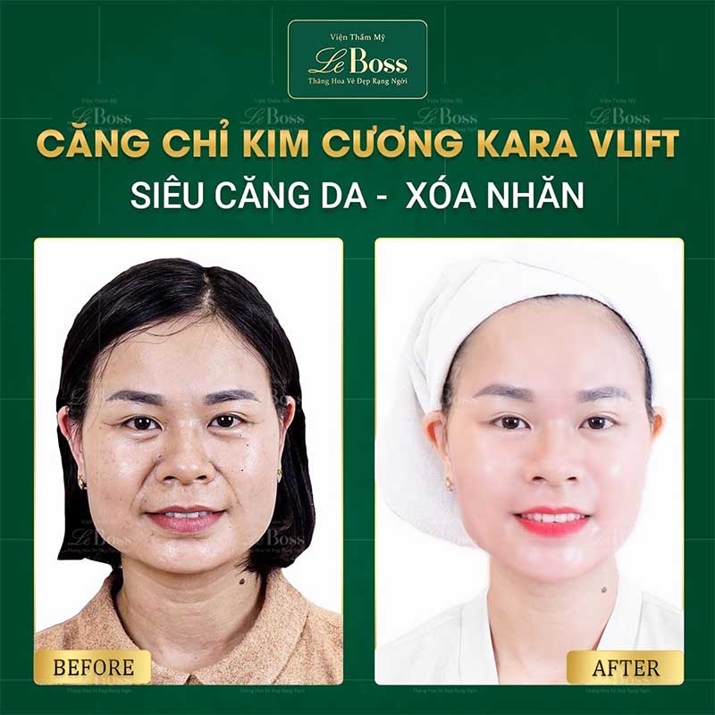 Chị Minh Lam - Nhân Viên Văn Phòng